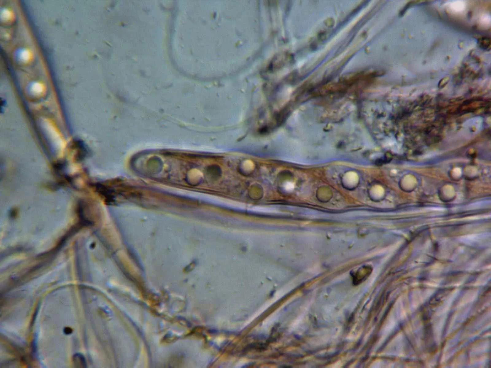 Microscopía de Propolis farinosa - 10 - Asca